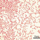 Bacteria P. aeruginosa teñida de rojo bajo un microscopio